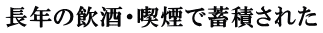 長年の飲酒・喫煙で蓄積された